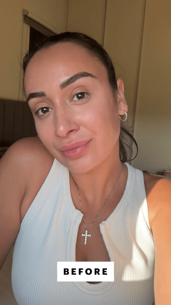 Trakoshis before applying Kosas Wet Lip Oil in Bare on her lips